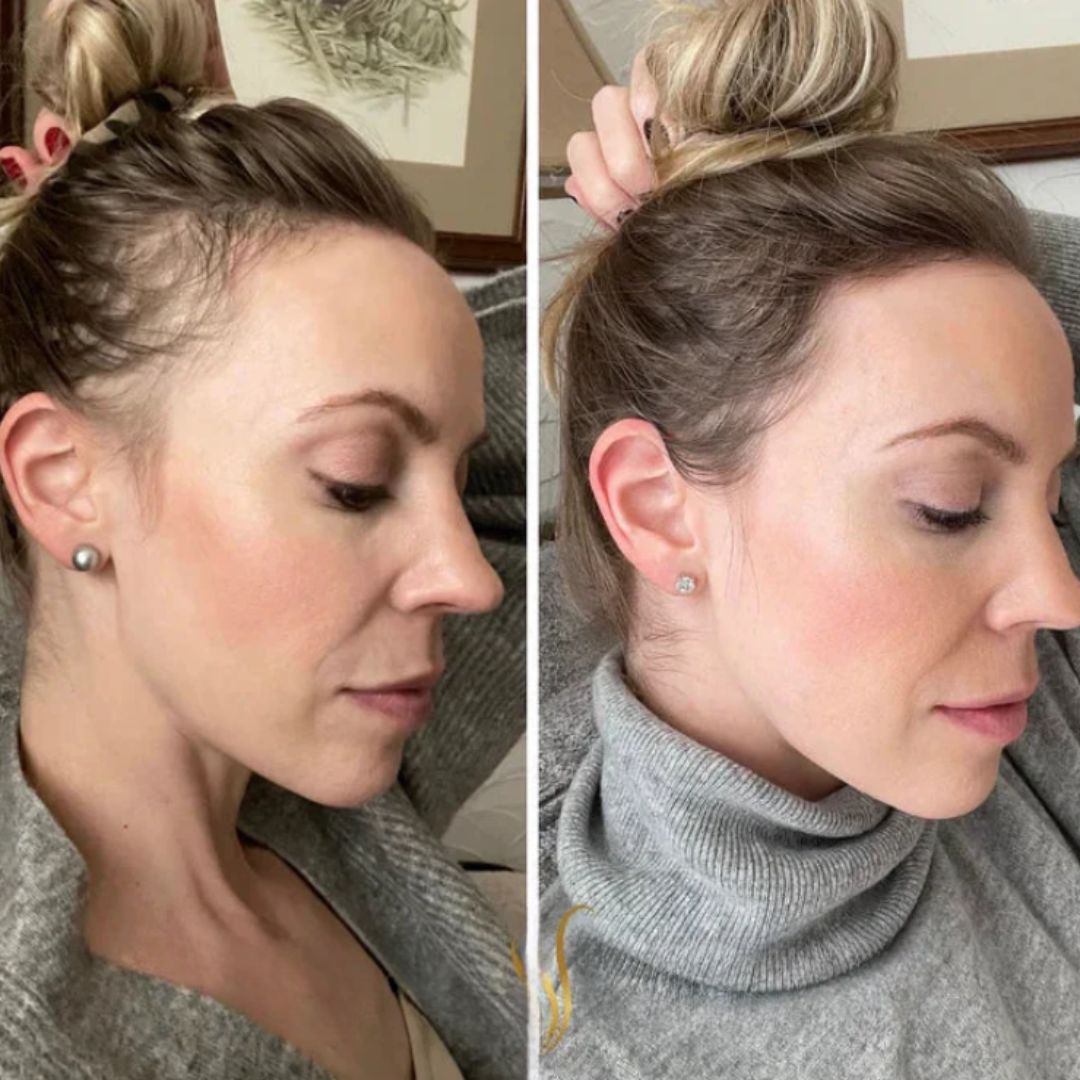 Anti-Hair™: Aceite regenerador anticaida